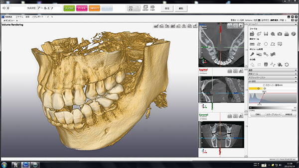正確な診断と安全な治療のために歯科用CT「NAOMI-CT」を導入